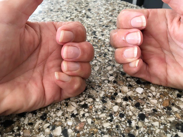 Wendy Munson customer nail photo